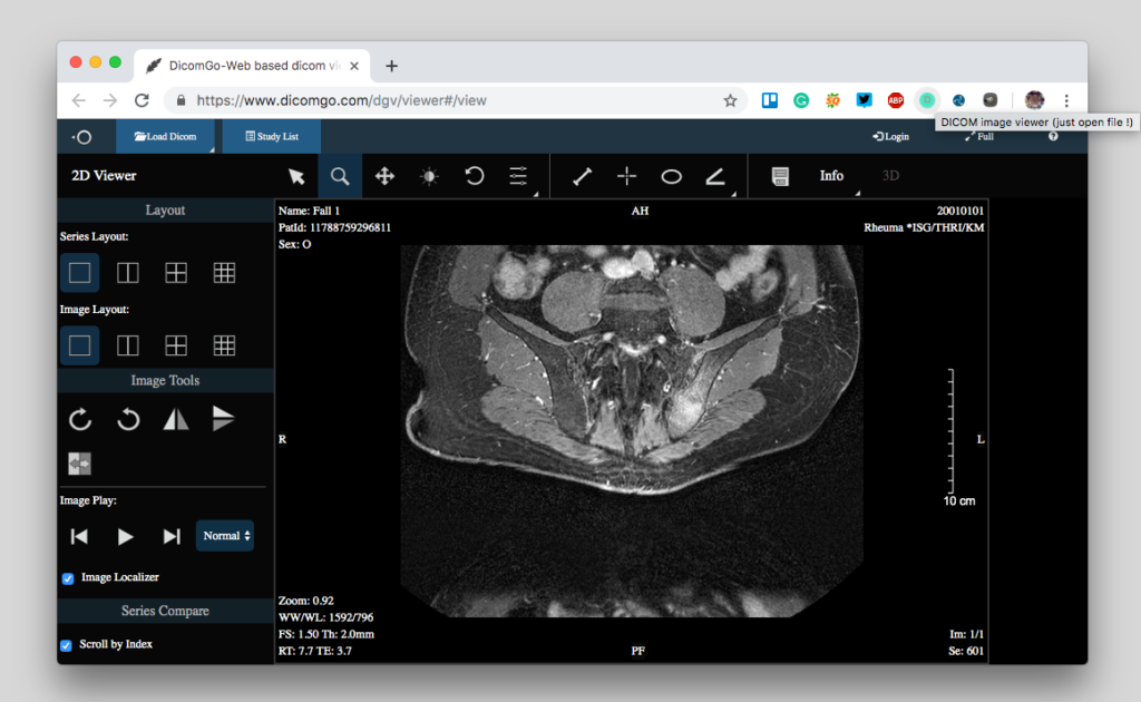 free online DICOM viewer