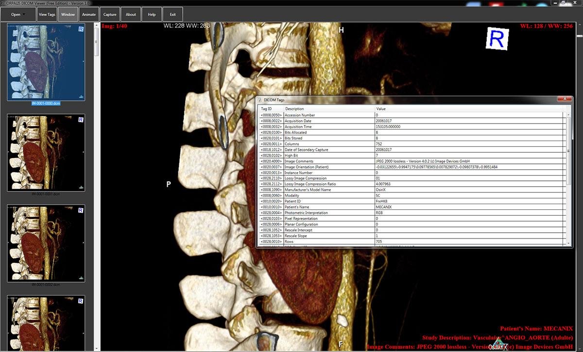 free online DICOM viewer