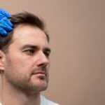 stem cell hair growth treatment